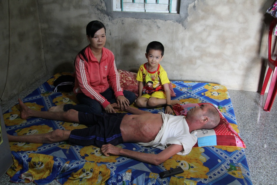 Nỗi khổ đau chồng chất của người đàn ông không dám cựa mình vì da nứt toác - 3 Nỗi khổ đau chồng chất của người đàn ông không dám cựa mình vì da nứt toác - 3