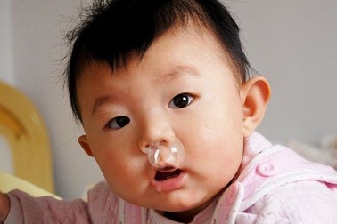 Trẻ vài bữa lại sổ mũi một lần, là bệnh gì?