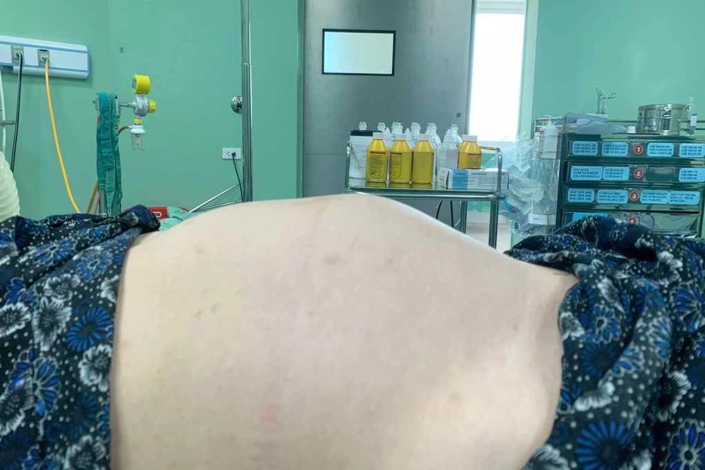 Thiếu nữ 18 tuổi có khối u buồng trứng như quả bóng đá - 1 Thiếu nữ 18 tuổi có khối u buồng trứng như quả bóng đá - 1