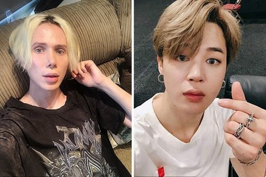 Thanh niên chi hơn 2 tỷ đồng để thẩm mỹ giống “sao Hàn”