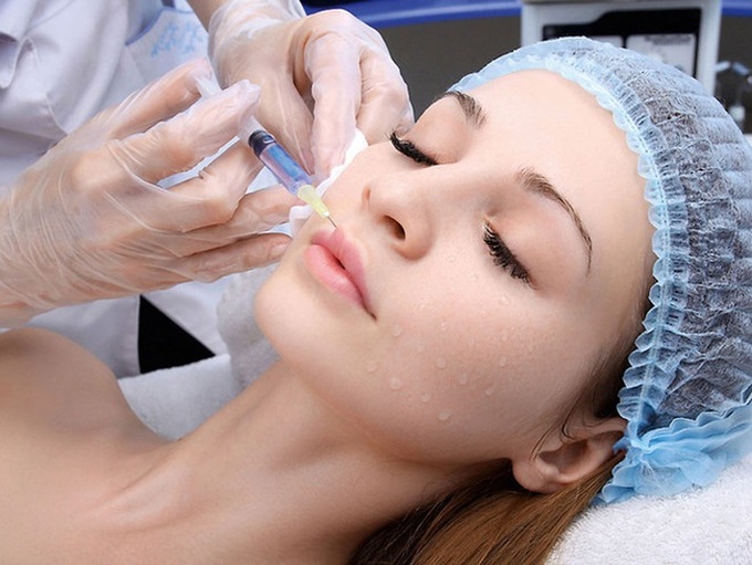 Nhiều người gặp biến chứng do tiêm filler trẻ hóa khuôn mặt, chuyên gia cảnh báo cần hết sức cẩn trọng - Ảnh 3. Nhiều người gặp biến chứng do tiêm filler trẻ hóa khuôn mặt, chuyên gia cảnh báo cần hết sức cẩn trọng - Ảnh 3.