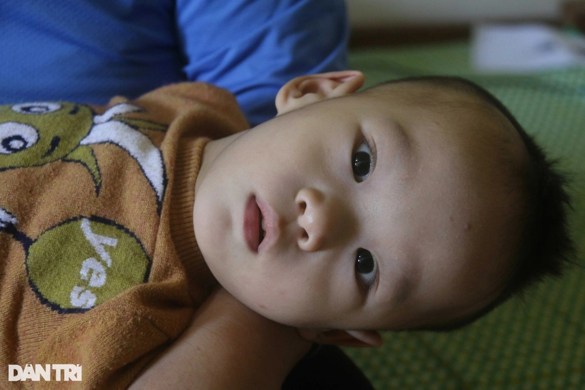 Thương cháu bé 3 tuổi vẫn co quắp, vật vã trong đau đớn như bị trời hành - 3 Thương cháu bé 3 tuổi vẫn co quắp, vật vã trong đau đớn như bị trời hành - 3