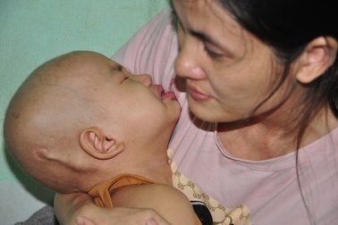 Tiếng khóc xé lòng của bé 3 tuổi bị u não thất