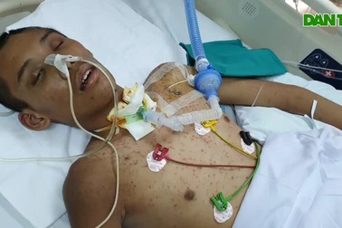 Xin hãy cho em cơ hội được sống!