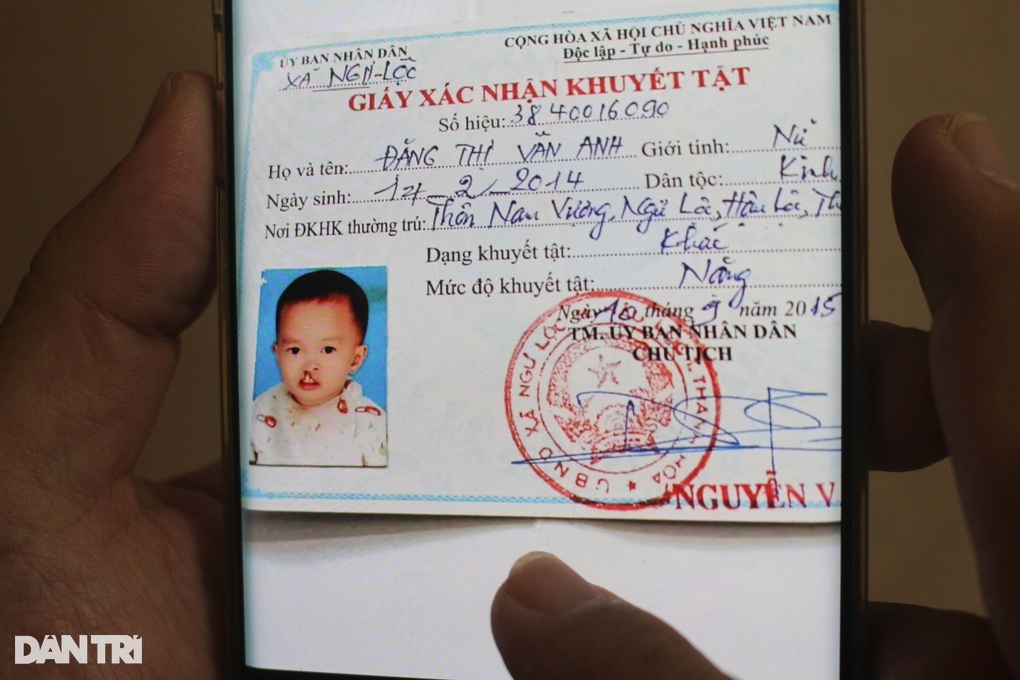 Những ca phẫu thuật 0 đồng và hành trình tìm lại nụ cười cho trẻ thơ - 1 Những ca phẫu thuật 0 đồng và hành trình tìm lại nụ cười cho trẻ thơ - 1