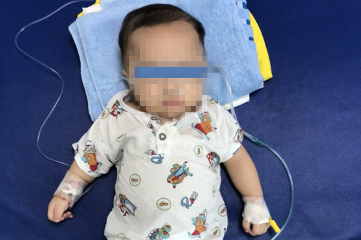 Biến chứng viêm thanh quản nặng vì Covid-19, bé trai 5 tháng tuổi nguy kịch - 1 Biến chứng viêm thanh quản nặng vì Covid-19, bé trai 5 tháng tuổi nguy kịch - 1