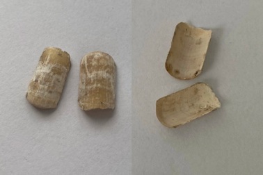 Công an Bình Dương công bố móng tay giả trong vụ 2 chân cháy xém