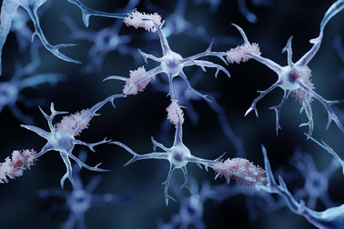 Truyền máu sẽ mở ra một hy vọng mới trong việc điều trị bệnh Alzheimer