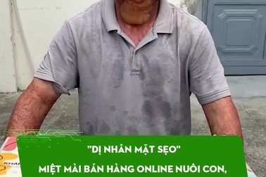 "Dị nhân mặt sẹo"miệt mài bán hàng online nuôi con, từ chối tiền ủng hộ