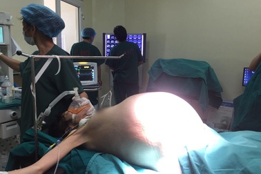 Bệnh nhân như mang bầu song sinh vì khối u 16kg trong bụng