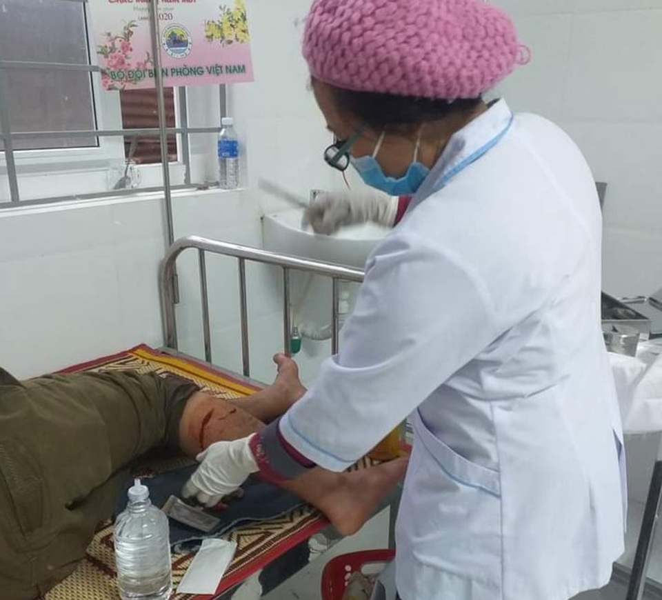 Bị voọc gáy trắng hung hãn tấn công, người đàn ông phải khâu 8 mũi - 1 Bị voọc gáy trắng hung hãn tấn công, người đàn ông phải khâu 8 mũi - 1