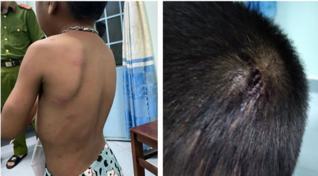 Dì ghẻ đối mặt án tử hình và những đứa trẻ bị đánh đập kinh hoàng - 7 Dì ghẻ đối mặt án tử hình và những đứa trẻ bị đánh đập kinh hoàng - 7