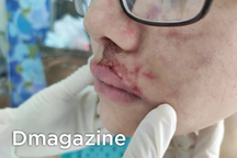 Mù mắt vì tiêm filler: Khi chị em "đánh cược" vào tiệm tóc, người quen