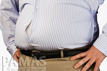 Tạo hình dạ dày cho bệnh nhân nặng hơn 100kg