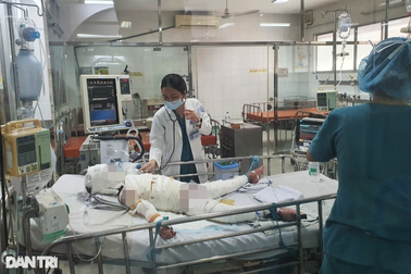 Bác sĩ bất lực nhìn bé trai 5 tuổi bỏng lửa cồn 93% tử vong