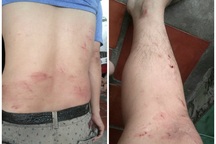 Người xuất hiện trong phóng sự điều tra "bất động sản đa cấp" bị hành hung