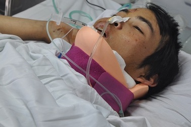 Bị đá đè gãy cổ, tính mạng chàng trai dân tộc Thái nguy kịch