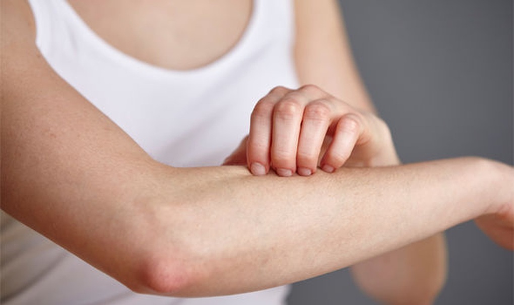 Ung thư đường mật giai đoạn cuối - 1 Ung thư đường mật giai đoạn cuối - 1
