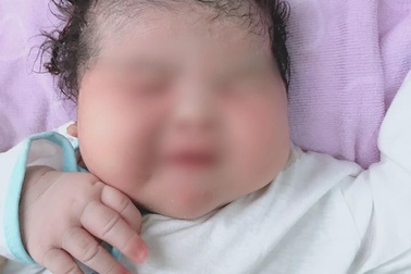 Bé gái sơ sinh nặng hơn 6kg ở Sóc Trăng