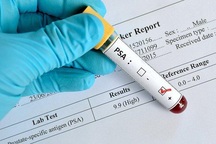 Các phương pháp chẩn đoán ung thư tuyến tiền liệt