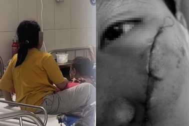 Bé gái co giật sau khi bị đánh bằng xẻng tại mái ấm ở TPHCM hiện ra sao?