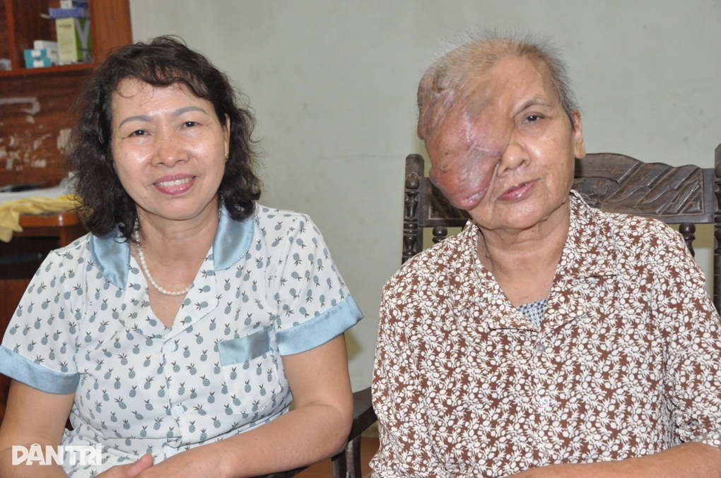 Người đàn bà có khối u khổng lồ bước đầu phẫu thuật thành công - 4 Người đàn bà có khối u khổng lồ bước đầu phẫu thuật thành công - 4