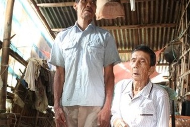 Cuộc sống vất vả của “gã khổng lồ” cao hơn 2m