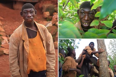 "Người rừng" 21 tuổi: Không biết nói, ăn cỏ, cả ngày đuổi theo động vật