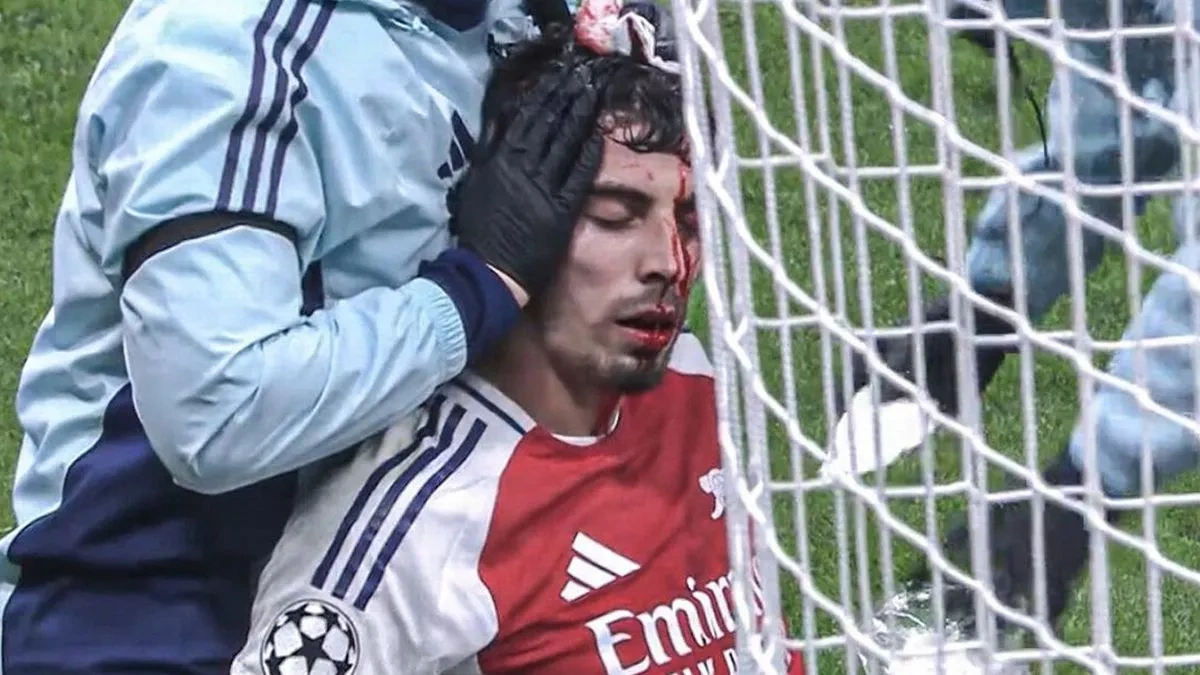 តារា Arsenal ហូរឈាមក្រោយប៉ះគ្នាជាមួយកីឡាករ Inter Milan - ១ Ngôi sao Arsenal đổ máu sau pha va chạm với cầu thủ Inter Milan - 1