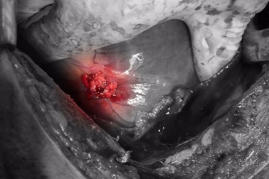 Mâu thuẫn cá nhân, thanh niên bị đâm thấu tim