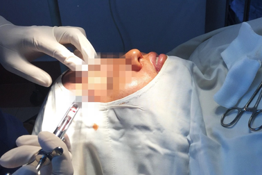 Xử lý hàng loạt cơ sở thẩm mỹ trên địa bàn TPHCM