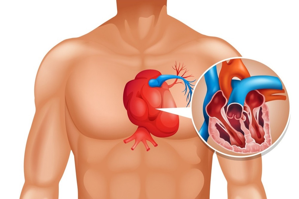 Triệu chứng của ung ung thư tim - 1 Triệu chứng của ung ung thư tim - 1