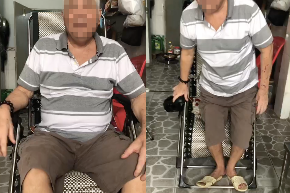 Nhiều người ở TPHCM bỗng liệt một bên cơ thể khi đang nấu ăn, dùng bữa - 3 Nhiều người ở TPHCM bỗng liệt một bên cơ thể khi đang nấu ăn, dùng bữa - 3