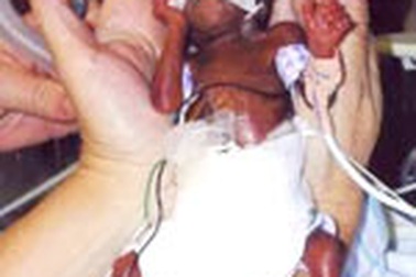 Những ca sinh đẻ kỳ diệu nhất hành tinh