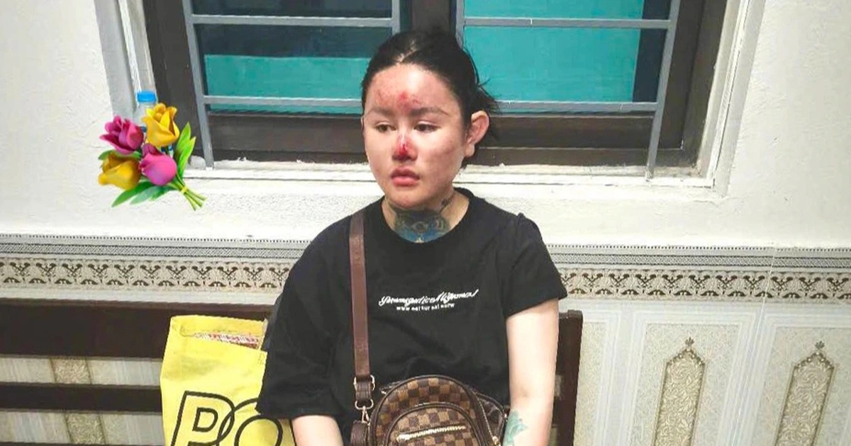 Tạm giữ hình sự Ngân "Baby"