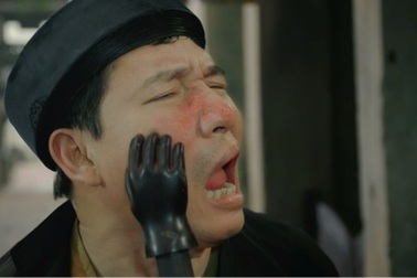 Cách trị chứng mẩn ngứa, mẩn đỏ do bệnh mề đay, dị ứng