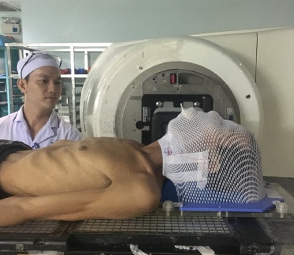 Đau ở lưỡi, bệnh nhân bàng hoàng phát hiện ung thư - 1 Đau ở lưỡi, bệnh nhân bàng hoàng phát hiện ung thư - 1
