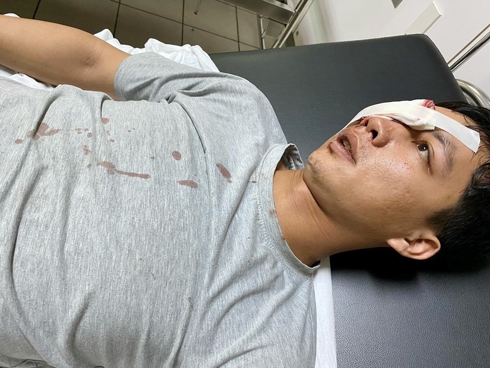 Bắt đối tượng xông vào trạm bảo vệ rừng dùng dao tấn công cán bộ - 2 Bắt đối tượng xông vào trạm bảo vệ rừng dùng dao tấn công cán bộ - 2