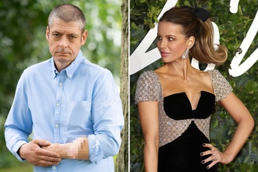 Người đàn ông nuôi "cậu nhỏ" trên cánh tay muốn hẹn hò Kate Beckinsale