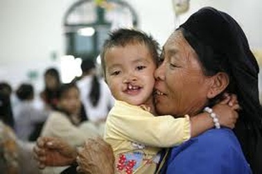 Hơn 2.000 trẻ nghèo bị sứt môi được phẫu thuật miễn phí