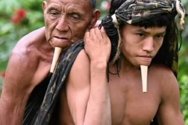 Câu chuyện xúc động phía sau bức ảnh khiến cả thế giới phải "thức tỉnh"