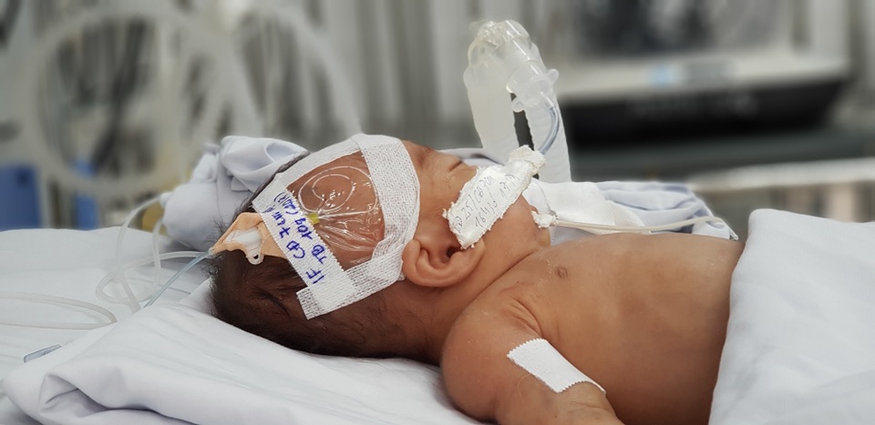 Sự sống mong manh của bé trai bị bỏ rơi hấp hối trong sân chùa - 2 Sự sống mong manh của bé trai bị bỏ rơi hấp hối trong sân chùa - 2