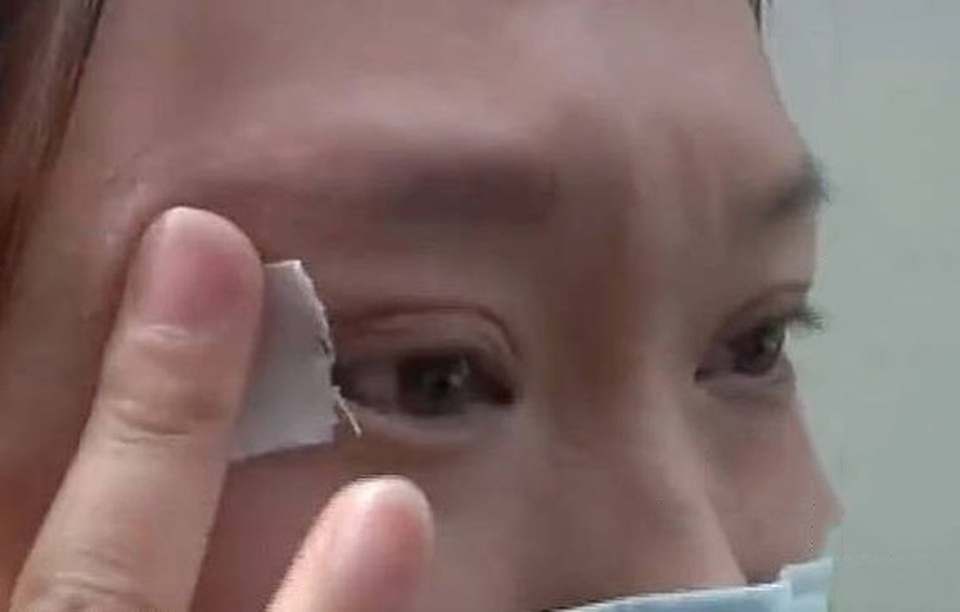 Muốn ngủ phải dán băng dính mí mắt sau phẫu thuật thẩm mỹ - 2 Muốn ngủ phải dán băng dính mí mắt sau phẫu thuật thẩm mỹ - 2