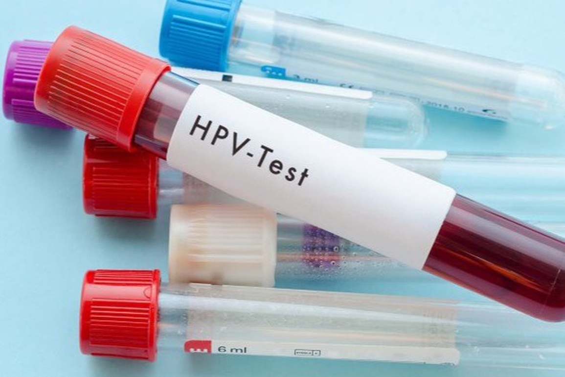 Nhiễm HPV có chữa được không? - 1 Nhiễm HPV có chữa được không? - 1