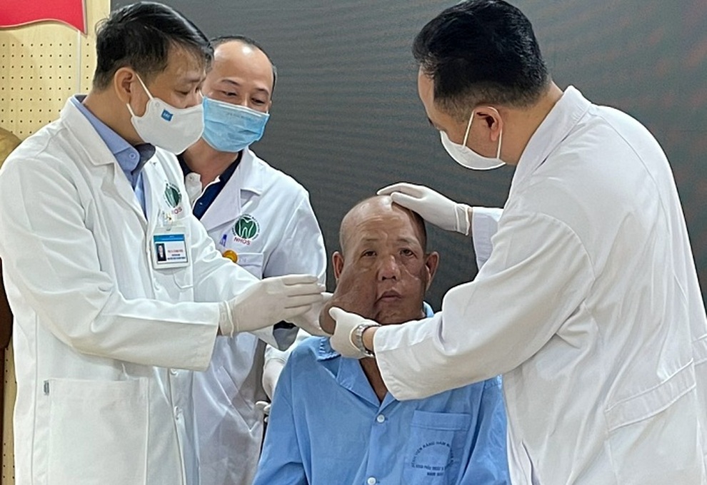 Khối u lớn ở má khiến người đàn ông bị biến dạng cả mặt - 2 Khối u lớn ở má khiến người đàn ông bị biến dạng cả mặt - 2