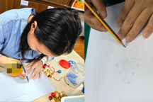 6 tiếng tạo nên kỳ tích cho người phụ nữ bị đứt lìa bàn tay phải