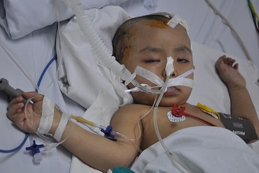 Bị sét đánh bất ngờ, mẹ chết, con 3 tuổi nguy kịch tính mạng