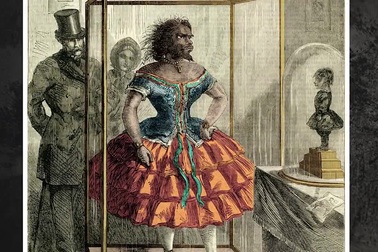 Cuộc đời bi kịch của người phụ nữ xấu nhất thế giới, đến chết vẫn không yên