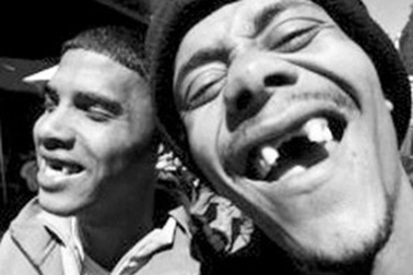 Nhổ răng cửa - mốt của giới trẻ 