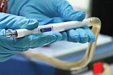 Phát triển thành công “dao thông minh” giúp phát hiện nhanh ung thư